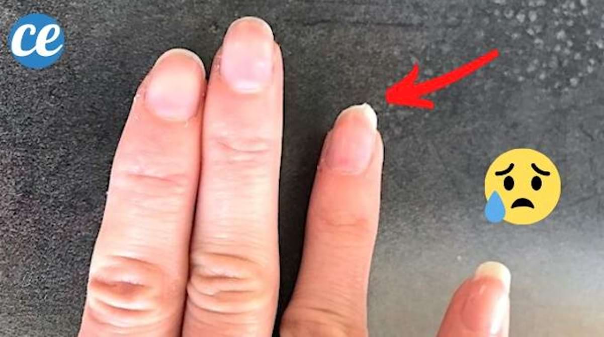 Ongles Cassants ? Le Remède Miracle Pour Des Ongles INCASSABLES
