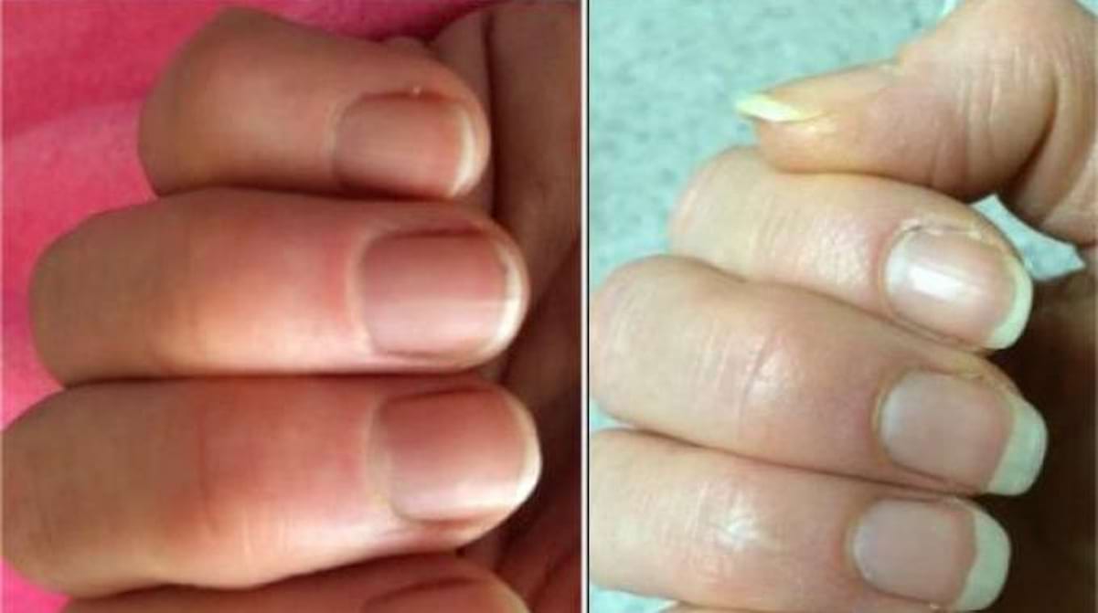 Le Remède De Grand Mère Pour Faire Pousser Vos Ongles Plus Vite