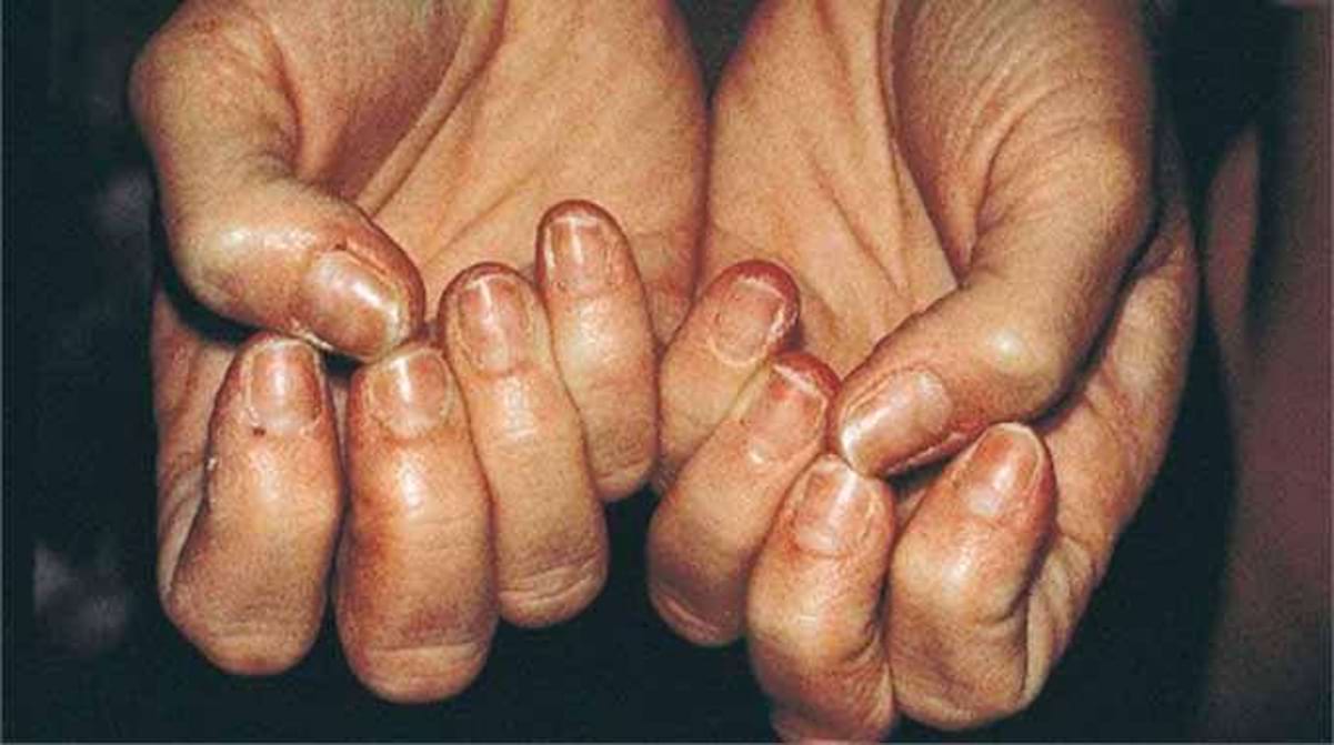 Lastuce Qui Marche Pour Durcir Des Ongles Mous